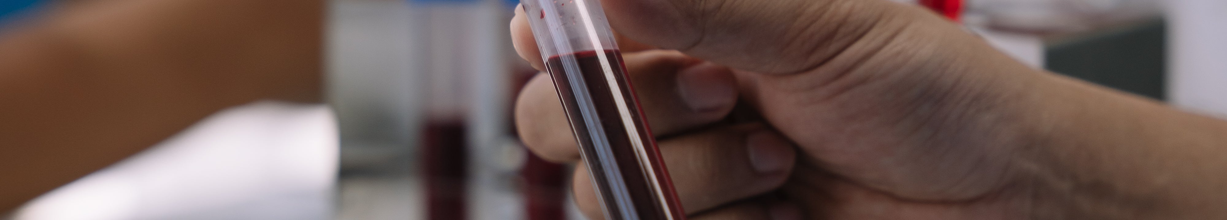 Guida all'interpretazione degli esami del sangue della tiroide